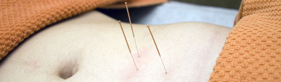 Accupuncture, Eastern Healing Arts in the Bucks County, PA area